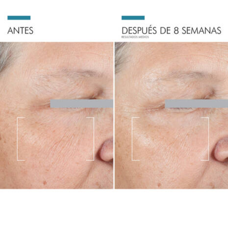 resultados-skinceuticals-age-advanced-eye-contorno-dos-olhos-15ml